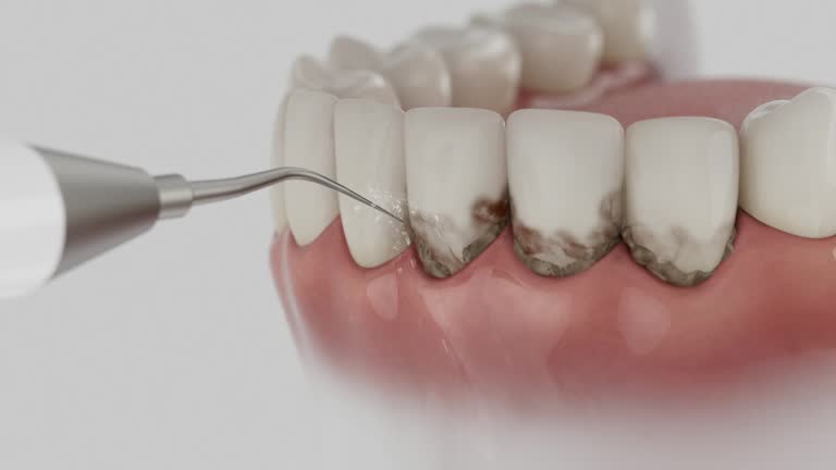 Trusted Dental Crowns And Bridges service in Lorena, TX - Dentist Open Now